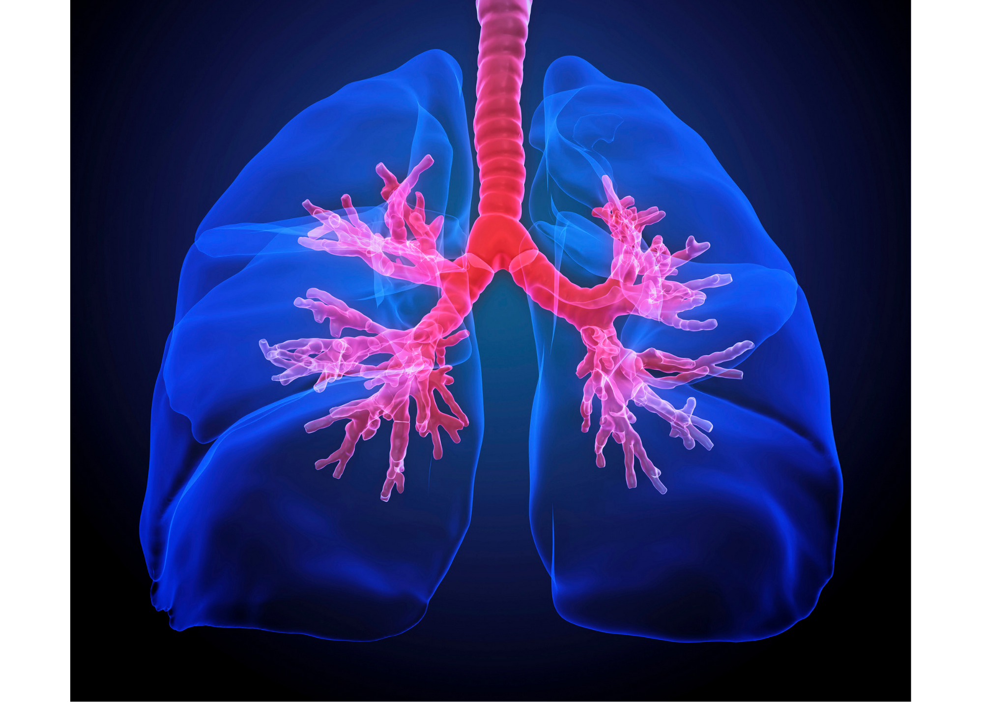 Chronic Obstructive Pulmonary Disease