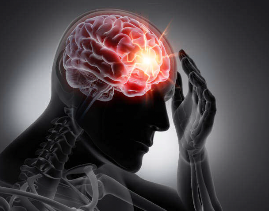 An Illustration of Stress and Trauma